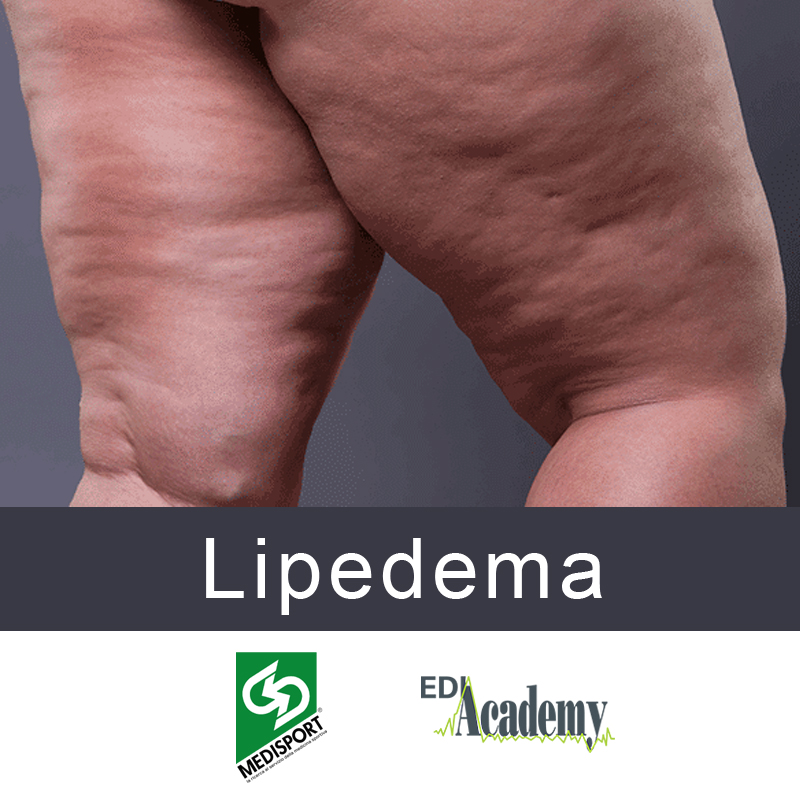 Advanced training course on Lipedema